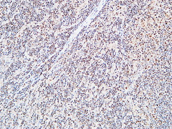 FOXP1 Polyclonal Antibody