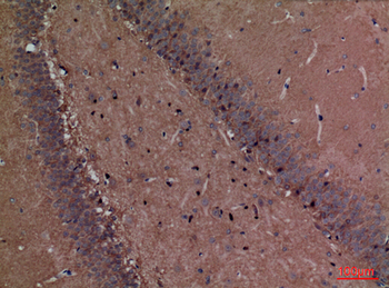 Fascin 1 Polyclonal Antibody