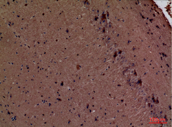 Fascin 1 Polyclonal Antibody