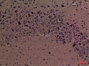 Fascin 1 Polyclonal Antibody