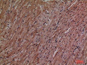P2X3 Polyclonal Antibody