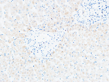 BLC Polyclonal Antibody