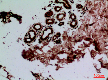 CEACAM1/5 Polyclonal Antibody