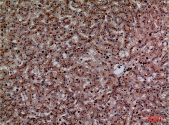 CEACAM1/5 Polyclonal Antibody