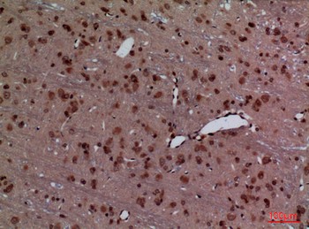 HoxD3 Polyclonal Antibody