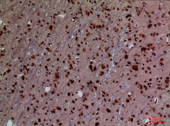 HoxD3 Polyclonal Antibody