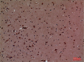 HoxD3 Polyclonal Antibody
