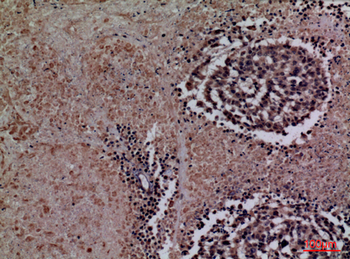 TF Polyclonal Antibody