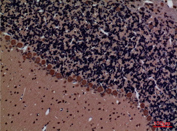 Rock-2 Polyclonal Antibody