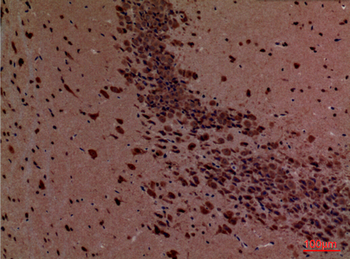 Rock-2 Polyclonal Antibody