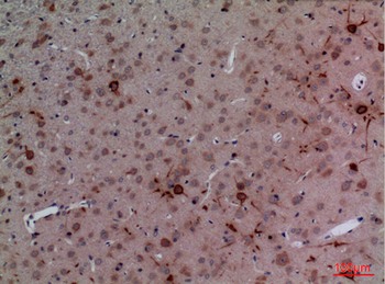 CUL-4B Polyclonal Antibody