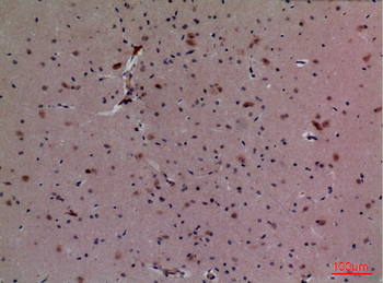 CUL-4B Polyclonal Antibody