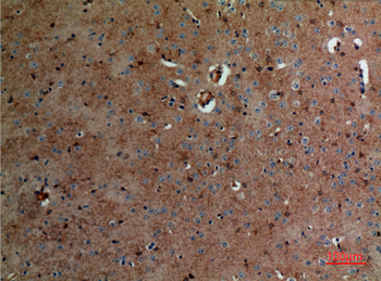 Aldolase C Polyclonal Antibody