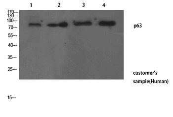 p63 Polyclonal Antibody
