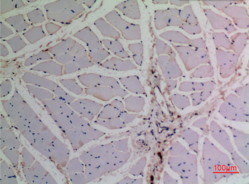 p63 Polyclonal Antibody