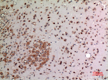 FGF-20 Polyclonal Antibody