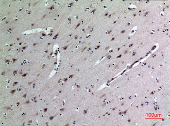 MK Polyclonal Antibody