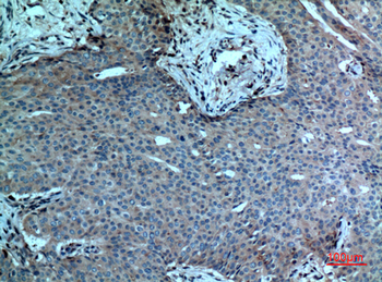 cPLA2 Polyclonal Antibody