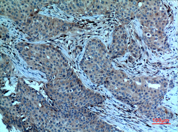 cPLA2 Polyclonal Antibody