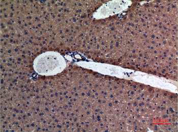 Amylase Polyclonal Antibody