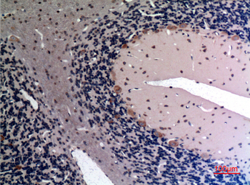 FGF-12 Polyclonal Antibody