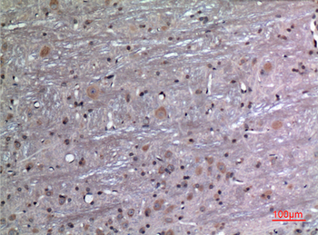 FGF-12 Polyclonal Antibody
