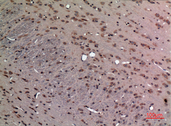 FGF-12 Polyclonal Antibody