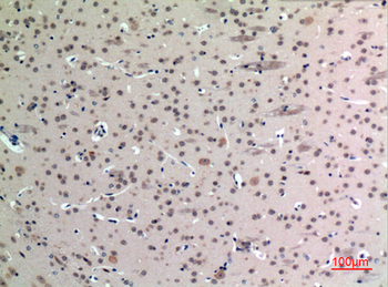 FGF-12 Polyclonal Antibody