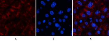 Catalase Polyclonal Antibody