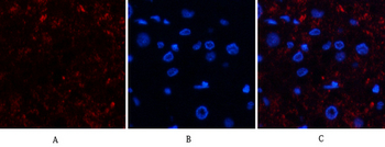 Catalase Polyclonal Antibody
