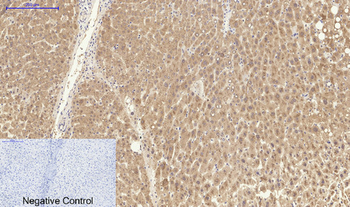 Catalase Polyclonal Antibody