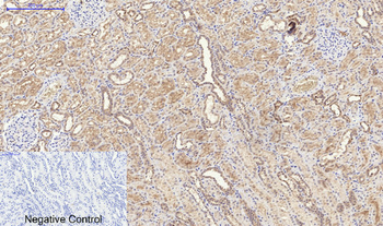 Catalase Polyclonal Antibody