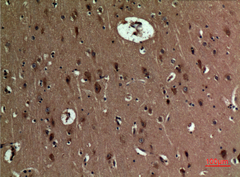 BNIP-3 Polyclonal Antibody
