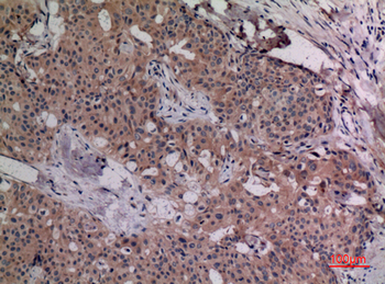 IL-4 Polyclonal Antibody