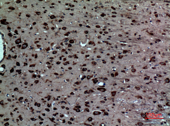 LXRα Polyclonal Antibody