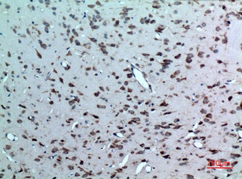 LXRα Polyclonal Antibody