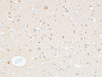 UCH-L1 Polyclonal Antibody