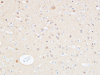 UCH-L1 Polyclonal Antibody