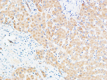 UCH-L1 Polyclonal Antibody