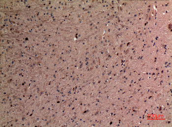 AFP Polyclonal Antibody