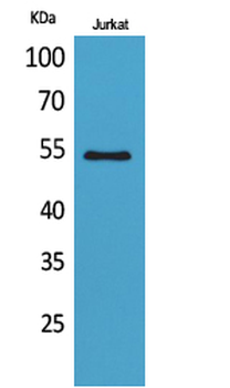 MMP-12 Polyclonal Antibody