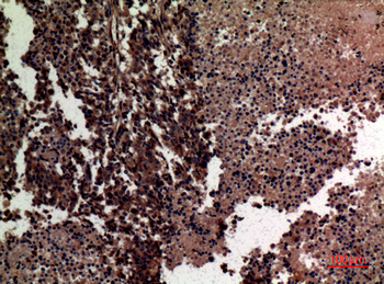 MMP-12 Polyclonal Antibody