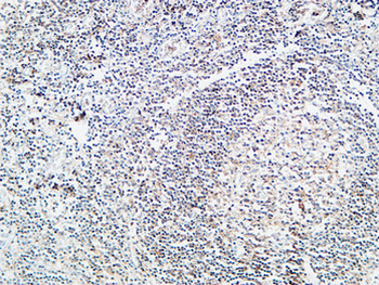 Prothrombin Polyclonal Antibody