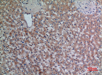 DPP7 Polyclonal Antibody
