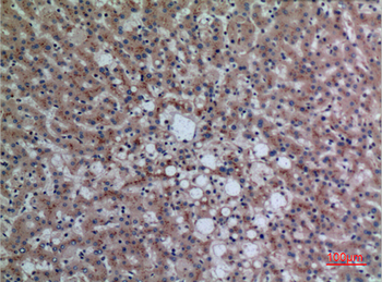 DPP7 Polyclonal Antibody