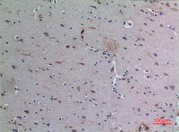 DPP7 Polyclonal Antibody