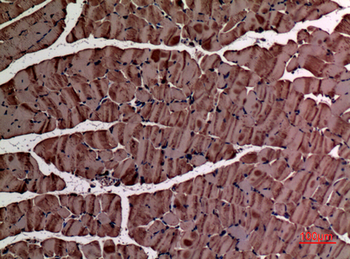 α-SMA Polyclonal Antibody