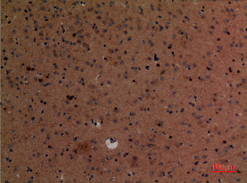 KLF12 Polyclonal Antibody