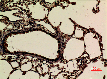 JAM-B Polyclonal Antibody