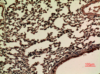 JAM-B Polyclonal Antibody